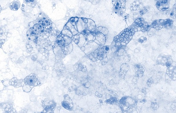 凍干機(jī)在生物組織保存中的應(yīng)用